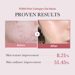 MEDICUBE Máscara Gel Medicube Salmon PDRN Pink Collagen (Brinde Gua Sha em Aço)